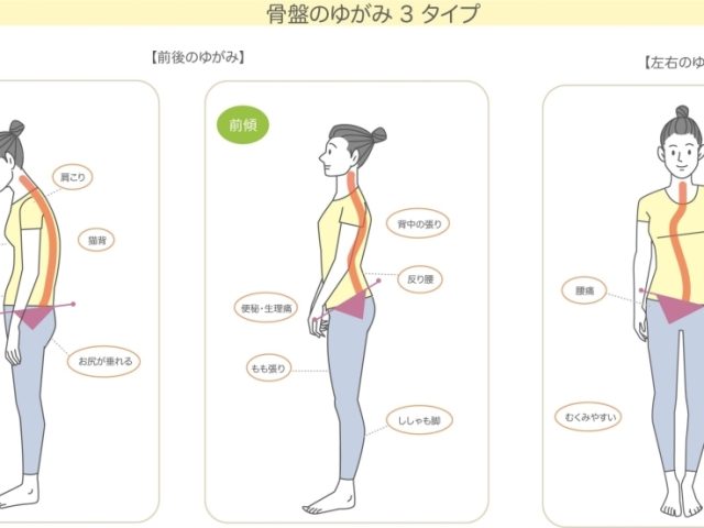 今回は美しい姿勢を保つために骨盤がどのように重要な役割を果たしているのか、というお話です♪